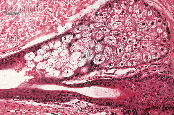 Large Sebaceous Gland,  LM