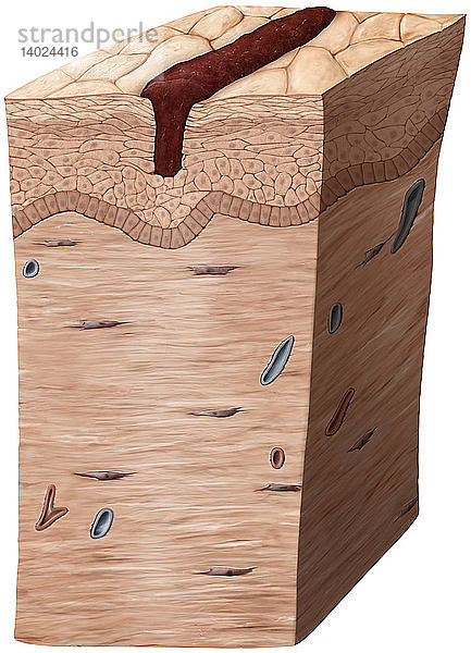 New tissue formation,  Illustration