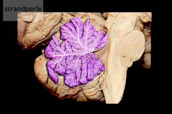 Color Enhanced Human Cerebellar Vermis