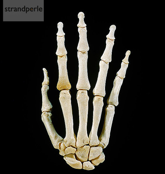 Bones of right hand