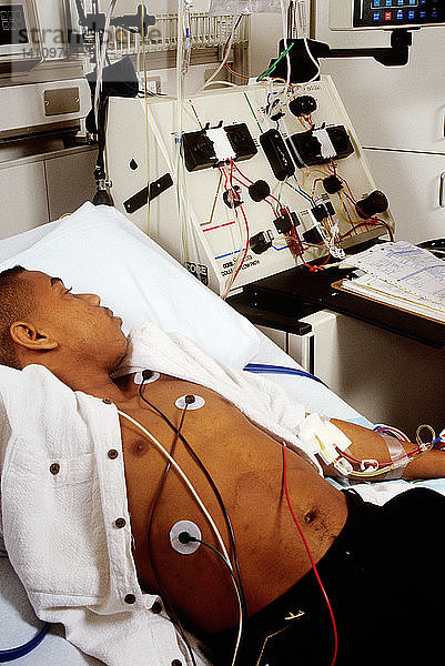 Blood transfusion for sickle-cell disease