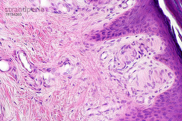 Meissner's Corpuscle,  LM