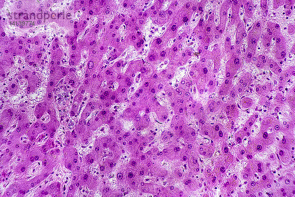 Human Liver Section,  LM