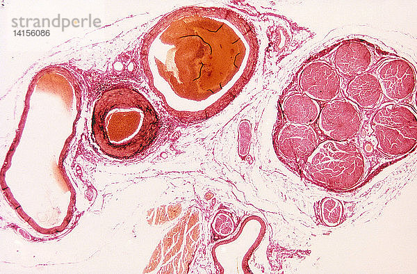 Artery,  Veins and Peripheral Nerve,  Micrograph