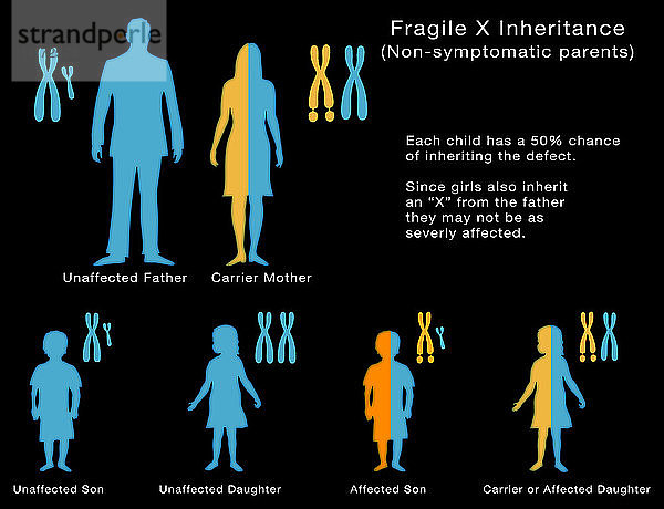 Fragile X Inheritance,  Illustration