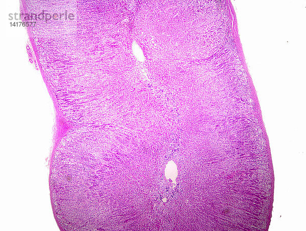 Human Adrenal Gland Section,  LM