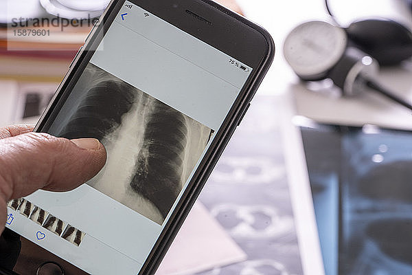 Hand einer Person,  die ein Röntgenbild auf einem Smartphone überprüft